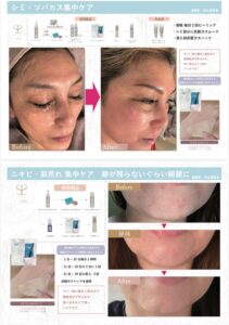 40代 スキンケア 順番｜SISの5step